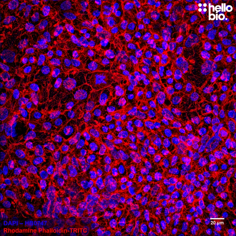 Figure 5. Fixed HEK293T cells mounted using MightyMount<sup>TM</sup> Antifade Fluorescence Mounting Medium with Phalloidin-TRITC (aqueous).