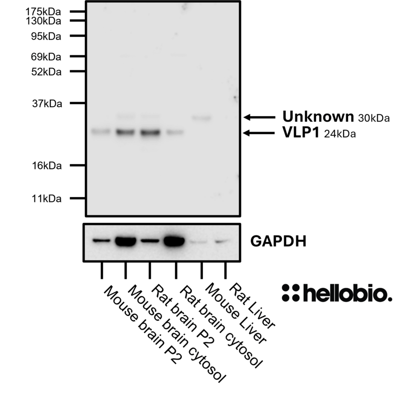 Figure 4. VLP1 expression in various tissue lysates and preparations.
