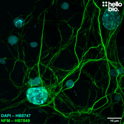 Anti-Neurofilament M (NF-M) antibody ValidAb Neurofilament M