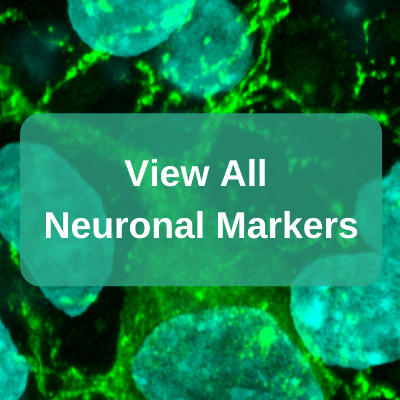 Transporters View all neuronal markers